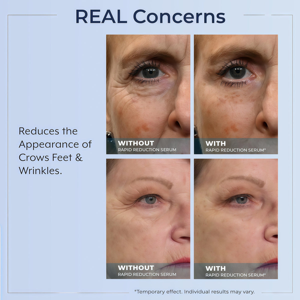 Rapid Reduction Serum – 1-Month Supply