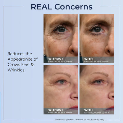Rapid Reduction Serum – 1-Month Supply