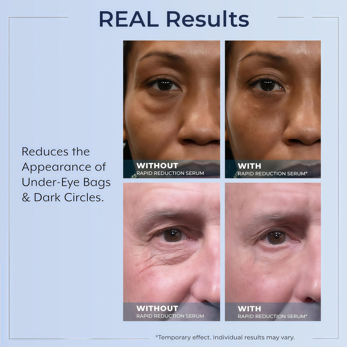 Rapid Reduction Serum – 1-Month Supply